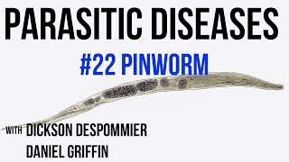 Parasitic Diseases Lectures 22 Pinworm [upl. by Klein852]