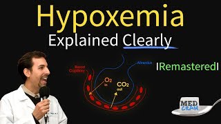 Understanding Hypoxia in High Altitude Environments [upl. by Aynosal]