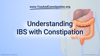 Understanding IBS with Constipation [upl. by Arezzini749]