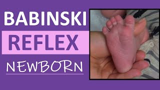 Babinski Reflex Assessment in Newborn Infant  Pediatric Nursing Clinical Skills [upl. by Haek299]