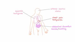 Signs and symptoms of hypoxemia [upl. by Akkina]