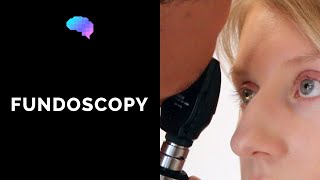 Fundoscopy Ophthalmoscopy  OSCE Guide  UKMLA  CPSA  PLAB 2 [upl. by Civ685]