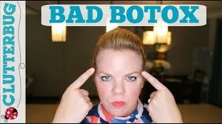 My Bad Botox Experience [upl. by Itnahs]