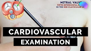 Cardiovascular Examination  OSCE Guide  UKMLA  CPSA  PLAB 2 [upl. by Afesoj]