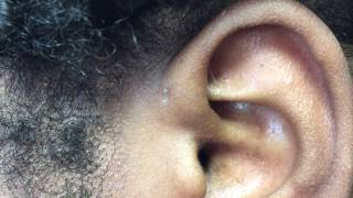 Vagus Nerve Hack  Auricular Ear Release [upl. by Orual]