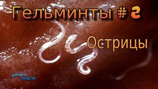 Гельминты 2 Острицы  Worms 2 Pinworms [upl. by Riay286]