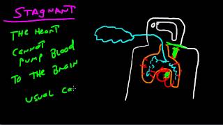 The Four Types Of Hypoxia [upl. by Eirelav144]