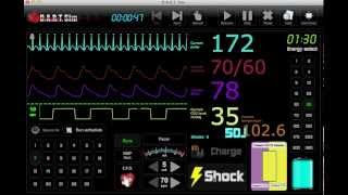 EKG Simulator  ECG Simulator [upl. by Briny616]