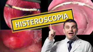 Histeroscopia [upl. by Steve]