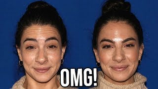 BOTOX BEFORE AND AFTER [upl. by Beitch]