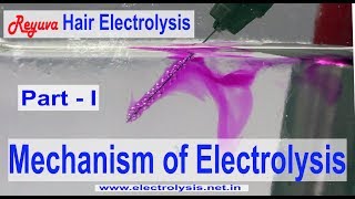 How Hair Electrolysis works [upl. by Valenza]