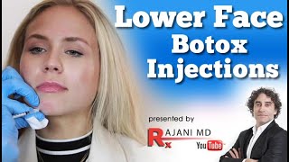 BOTOX INJECTIONS Side Effects Risks Cost amp Experience  Doctor ER [upl. by Aihtibat]