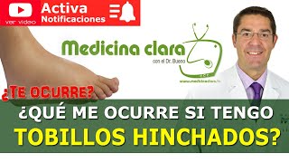 TOBILLOS HINCHADOS Dolor en los Tobillos Causas y soluciones  Medicina Clara [upl. by Roana]