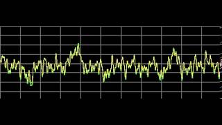 Candidiasis Candida Albicans  Rife Frequencies [upl. by Coltun]